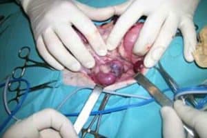 Service de chirurgie des tissus mous