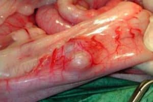 Service de chirurgie des tissus mous