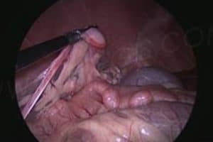 Service de chirurgie des tissus mous