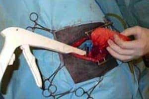 Service de chirurgie des tissus mous