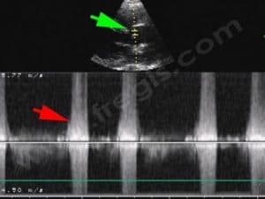 Akita Inu, echographie communication interventriculaire