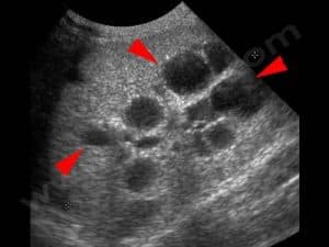 Echographie des reins d’un chat Persan atteint de polykystose rénale (PKD)