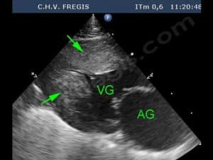 Cardiomyopathie hypertrophique chez le Sphynx