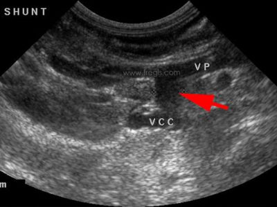 Diagnostic du shunt porto-systémique congénital chez le chien